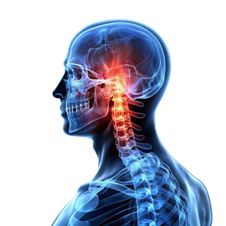 Neurosurgery Illustration
